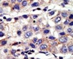 CBX4 Antibody in Immunohistochemistry (IHC)