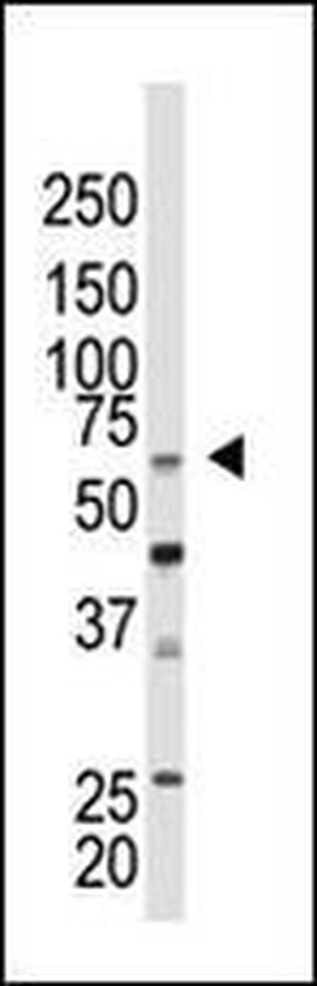 CBX4 Antibody in Western Blot (WB)