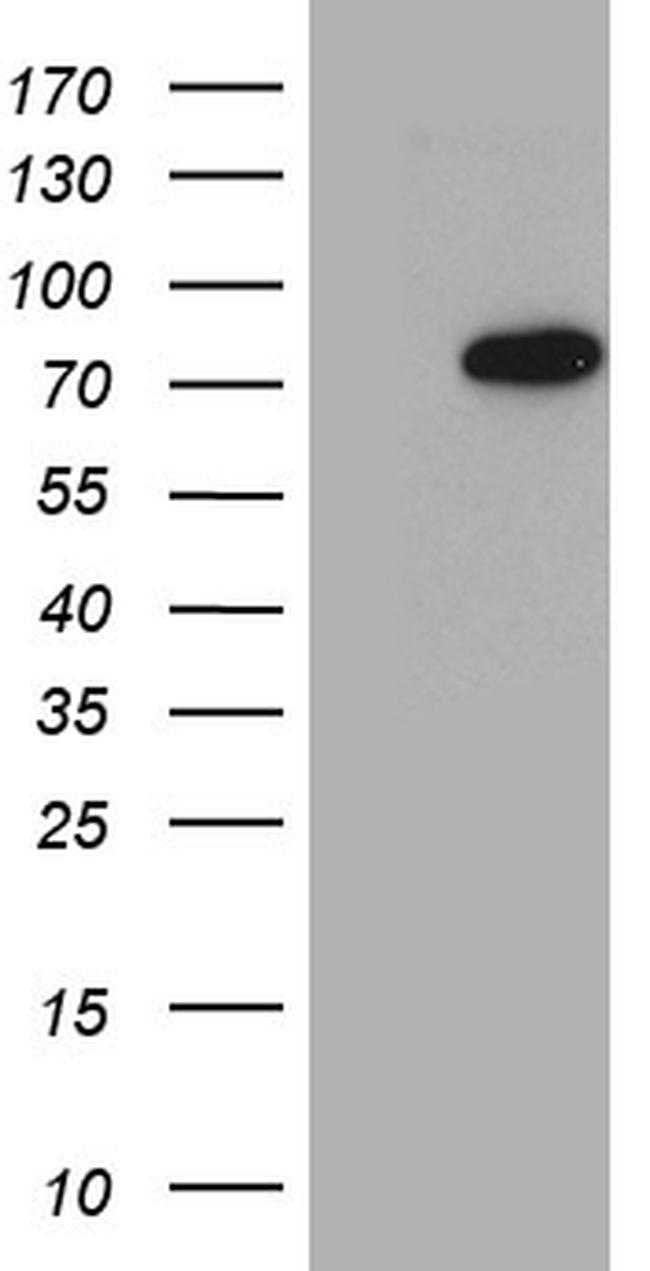 PCCA Monoclonal Antibody (OTI1B10) (TA810969)
