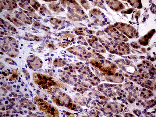 PCMT1 Antibody in Immunohistochemistry (Paraffin) (IHC (P))