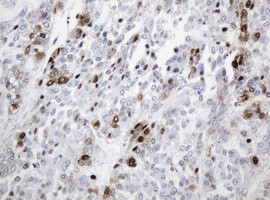 PCNA Antibody in Immunohistochemistry (Paraffin) (IHC (P))