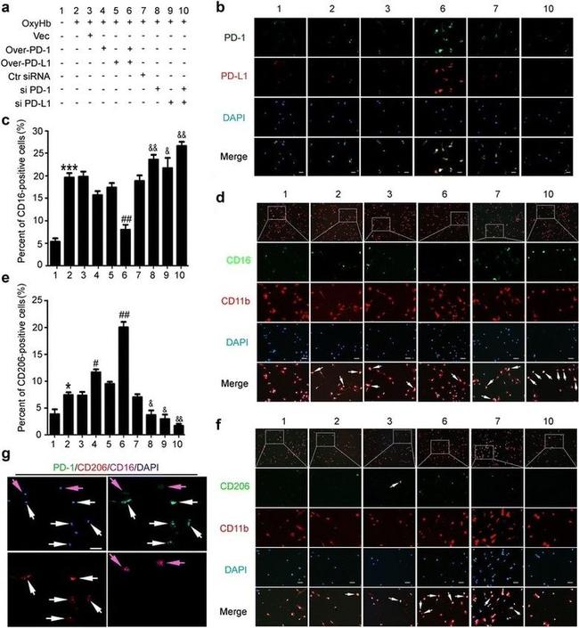 PD-L1 Antibody in Immunohistochemistry (IHC)