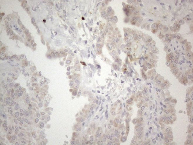 PD-L2 (PDCD1LG2) Antibody in Immunohistochemistry (Paraffin) (IHC (P))