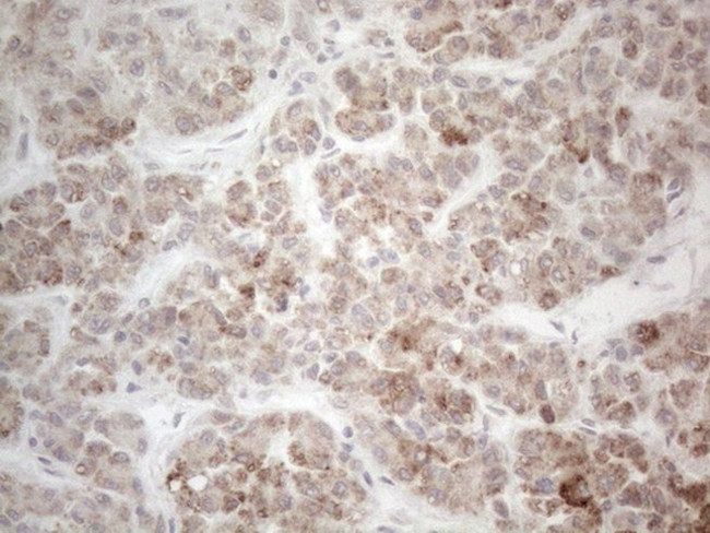 PD-L2 (PDCD1LG2) Antibody in Immunohistochemistry (Paraffin) (IHC (P))