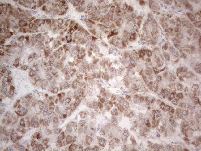 PD-L2 (PDCD1LG2) Antibody in Immunohistochemistry (Paraffin) (IHC (P))