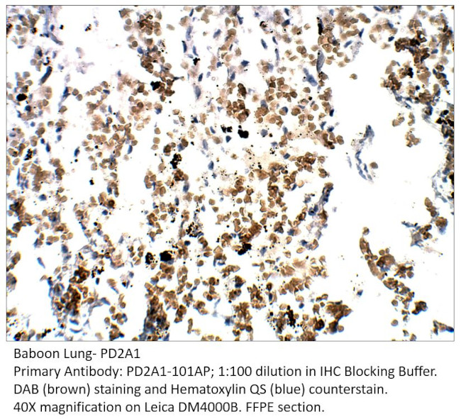 PDE2A1 Antibody in Immunohistochemistry (IHC)