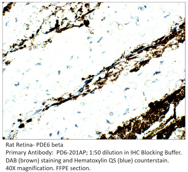 PDE6 Beta Antibody in Immunohistochemistry (IHC)
