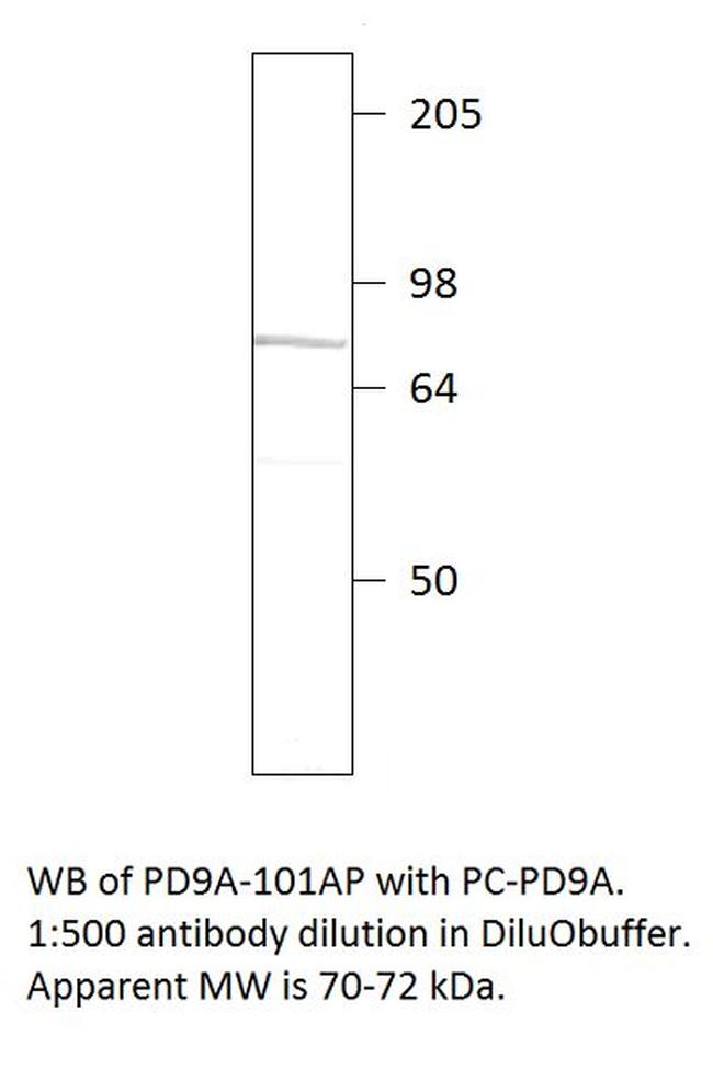 PDE9A Antibody in Western Blot (WB)