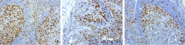 PDCD1 Antibody in Immunohistochemistry (Paraffin) (IHC (P))