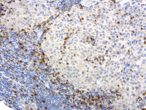 PDCD1 Antibody in Immunohistochemistry (Paraffin) (IHC (P))