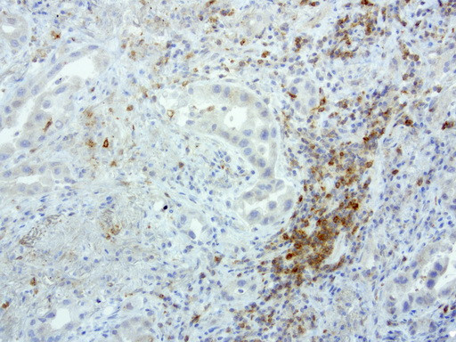 PDCD1 Antibody in Immunohistochemistry (Paraffin) (IHC (P))