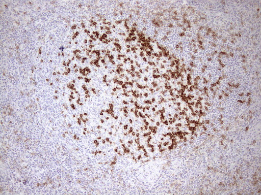 PDCD1 Antibody in Immunohistochemistry (Paraffin) (IHC (P))