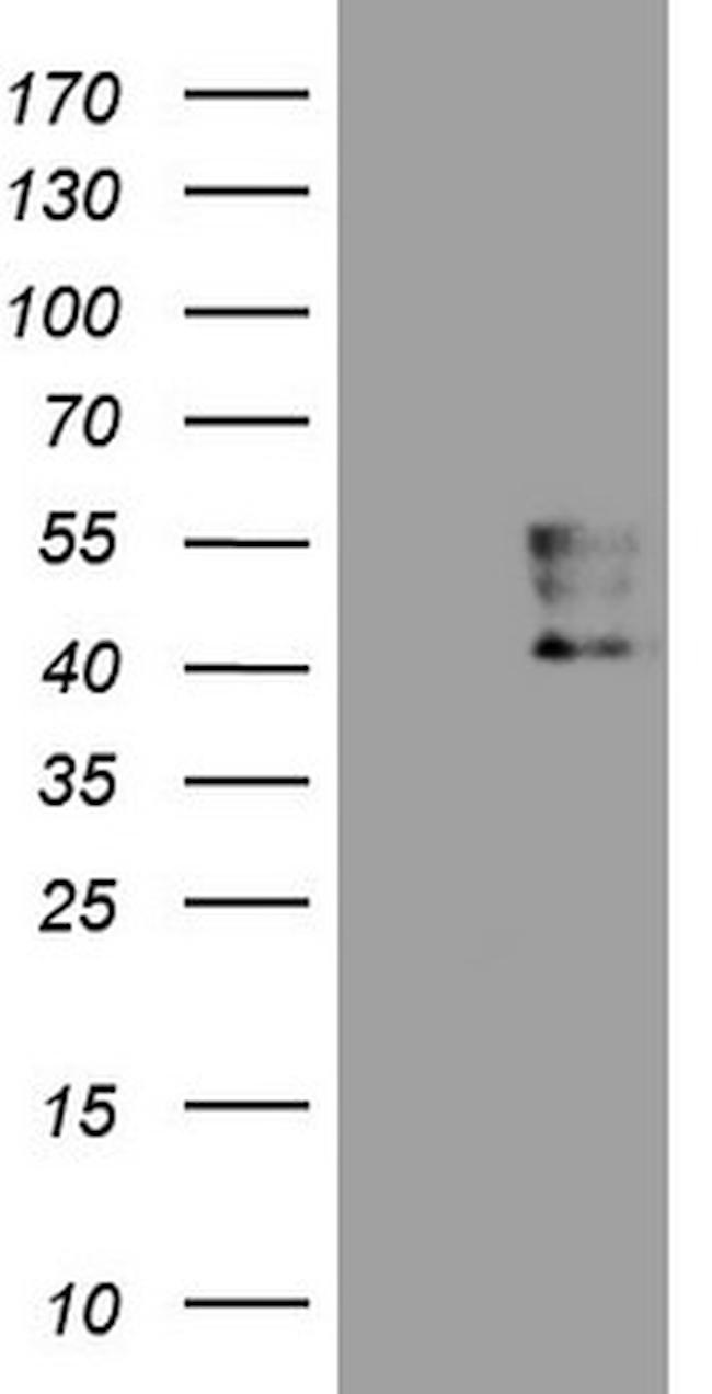 PDCD1 Antibody in Western Blot (WB)