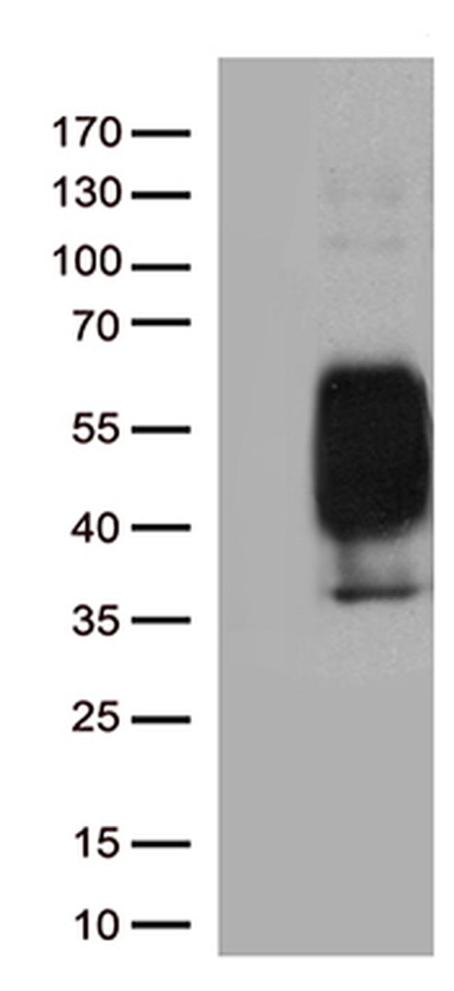 PDCD1 Antibody in Western Blot (WB)