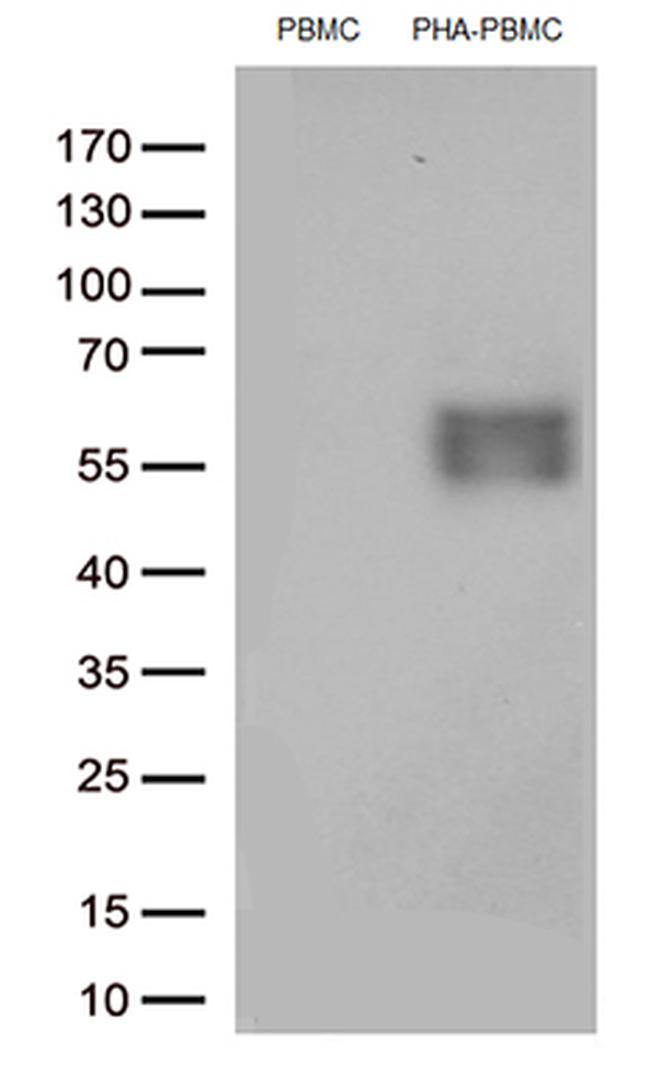 PDCD1 Antibody in Western Blot (WB)