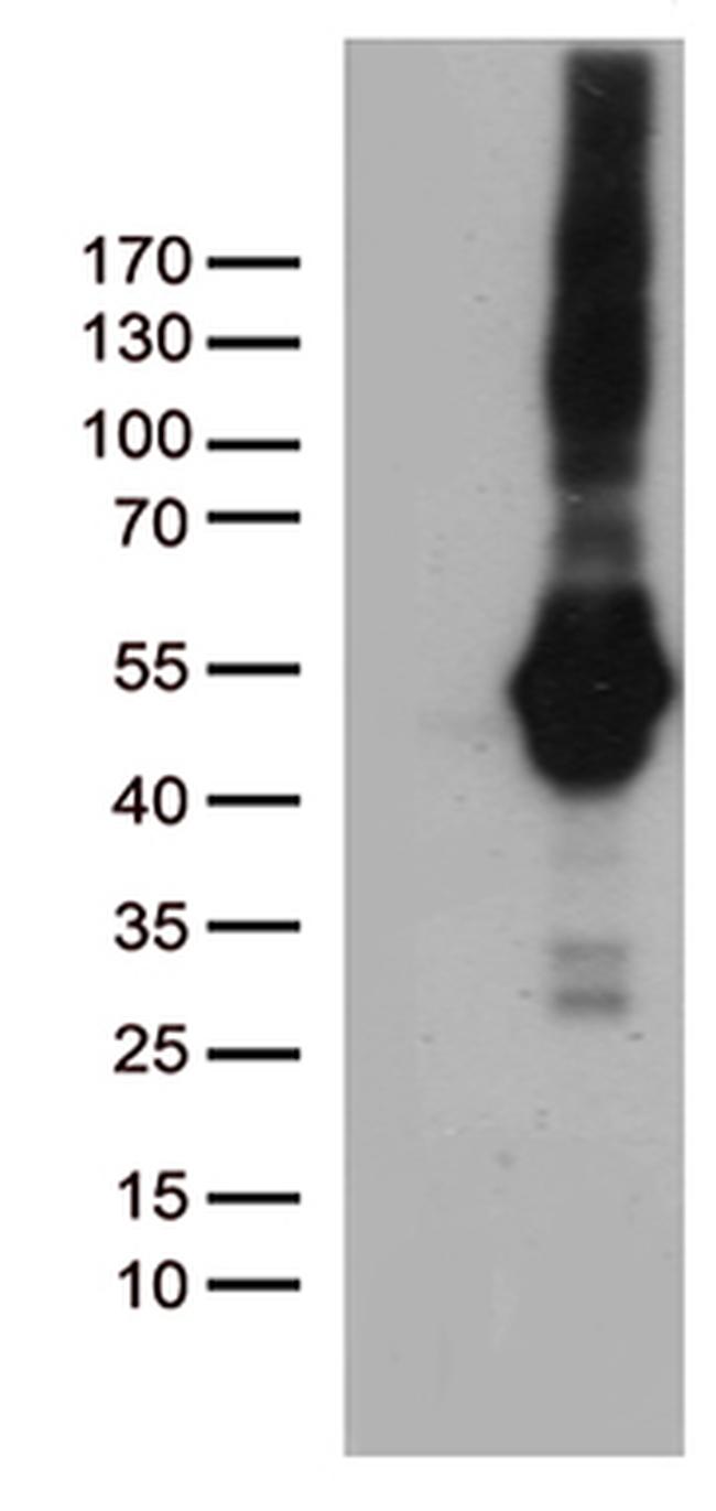 PDCD2L Antibody in Western Blot (WB)