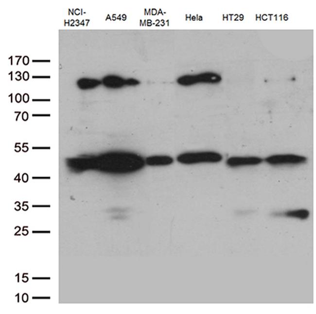 PDCD2L Antibody in Western Blot (WB)