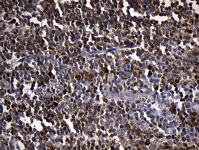 PDCL3 Antibody in Immunohistochemistry (Paraffin) (IHC (P))