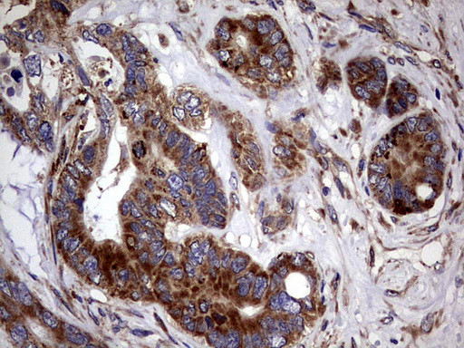 PDE1A Antibody in Immunohistochemistry (Paraffin) (IHC (P))