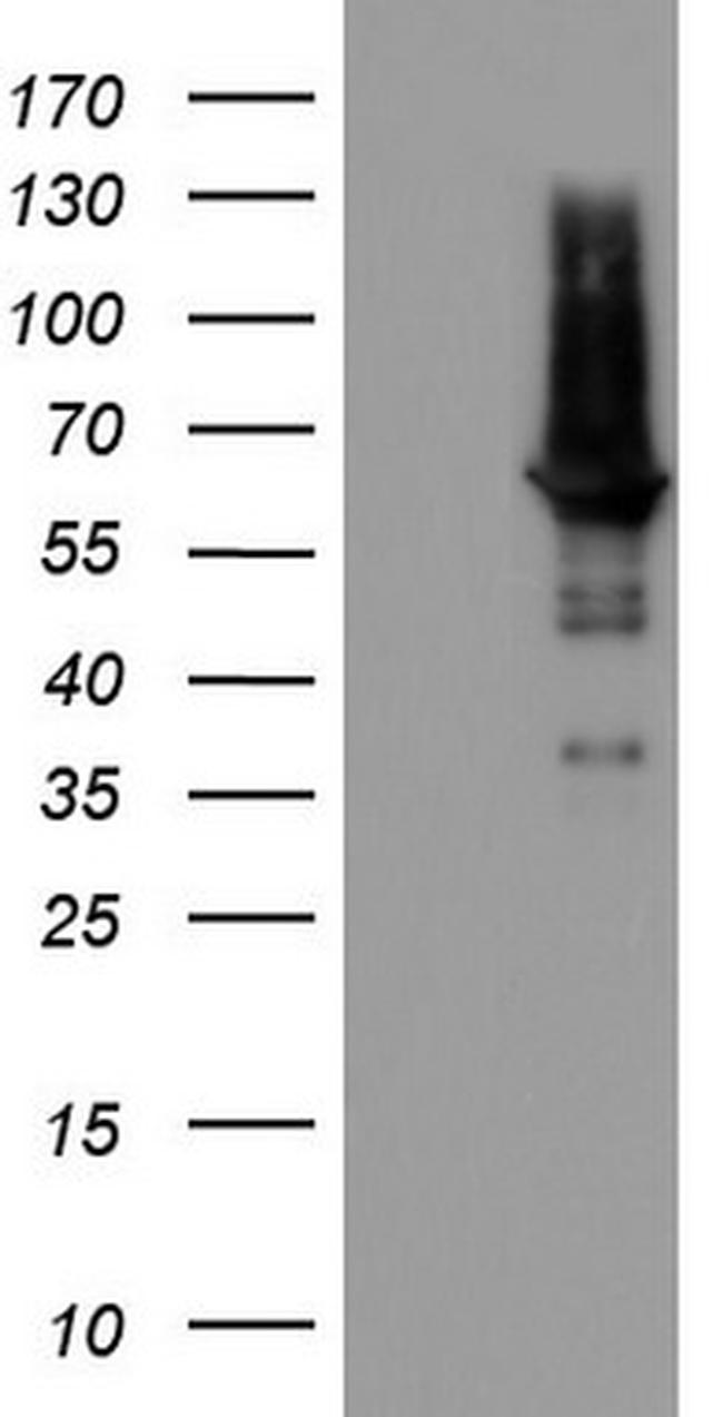 PDE1A Antibody in Western Blot (WB)