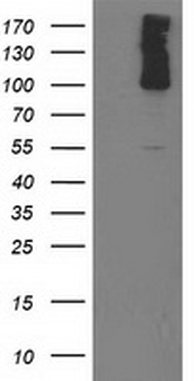 PDE2A Antibody in Western Blot (WB)