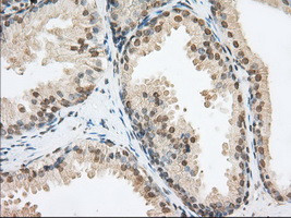 PDE4A Antibody in Immunohistochemistry (Paraffin) (IHC (P))