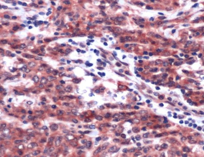 PDGFRB Antibody in Immunohistochemistry (IHC)