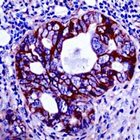 PDGFRB Antibody in Immunohistochemistry (IHC)