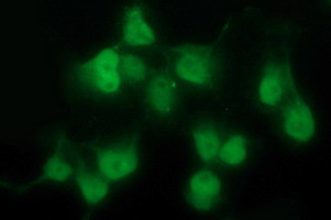 PDGFRB Antibody in Immunocytochemistry (ICC/IF)