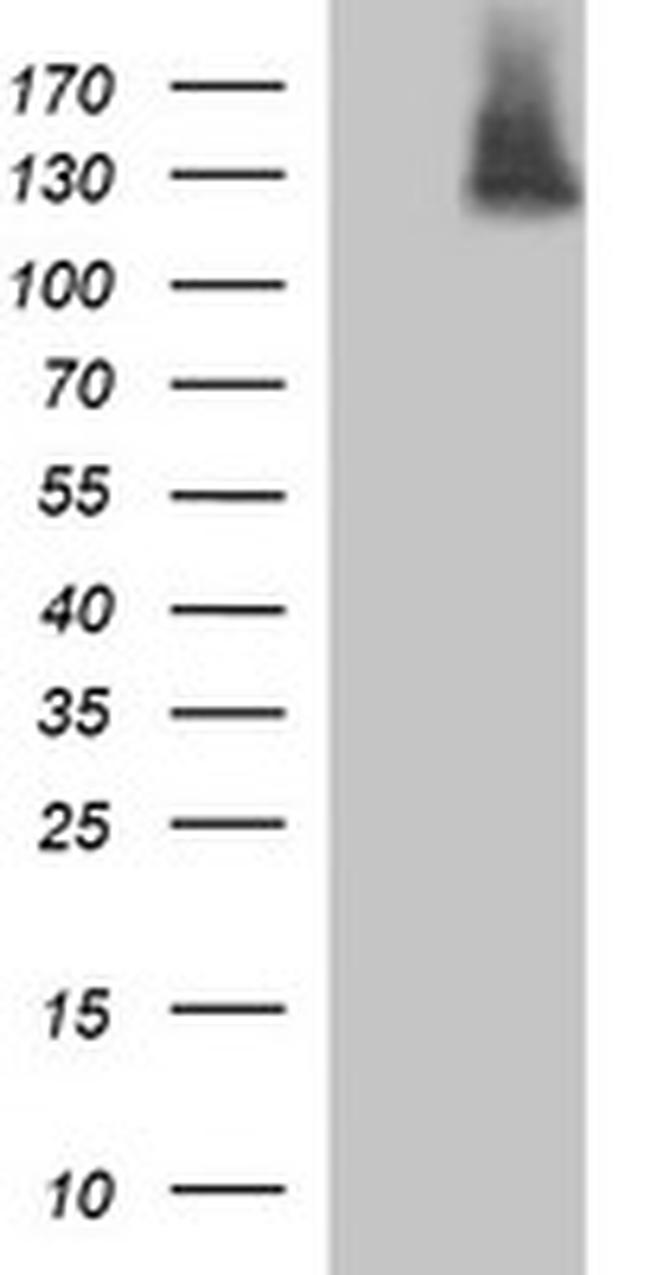 PDGFRB Antibody in Western Blot (WB)