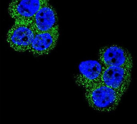 PDGFRB Antibody in Immunocytochemistry (ICC/IF)