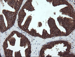 PDIA3 Antibody in Immunohistochemistry (Paraffin) (IHC (P))