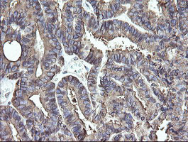 PDIA3 Antibody in Immunohistochemistry (Paraffin) (IHC (P))