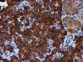 PDIA4 Antibody in Immunohistochemistry (Paraffin) (IHC (P))