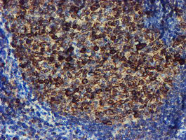 PDIA4 Antibody in Immunohistochemistry (Paraffin) (IHC (P))