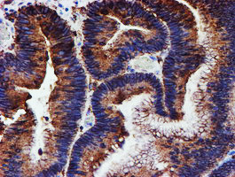 PDIA4 Antibody in Immunohistochemistry (Paraffin) (IHC (P))