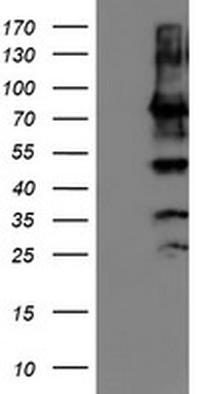 PDIA4 Antibody in Western Blot (WB)