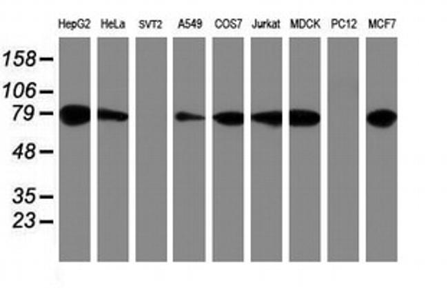 PDIA4 Antibody in Western Blot (WB)