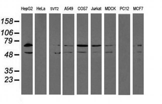 PDIA4 Antibody in Western Blot (WB)