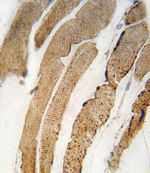 PDK4 Antibody in Immunohistochemistry (IHC)