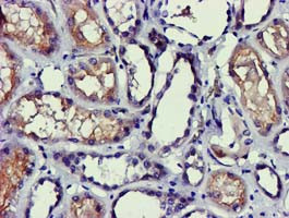 PDLIM2 Antibody in Immunohistochemistry (Paraffin) (IHC (P))