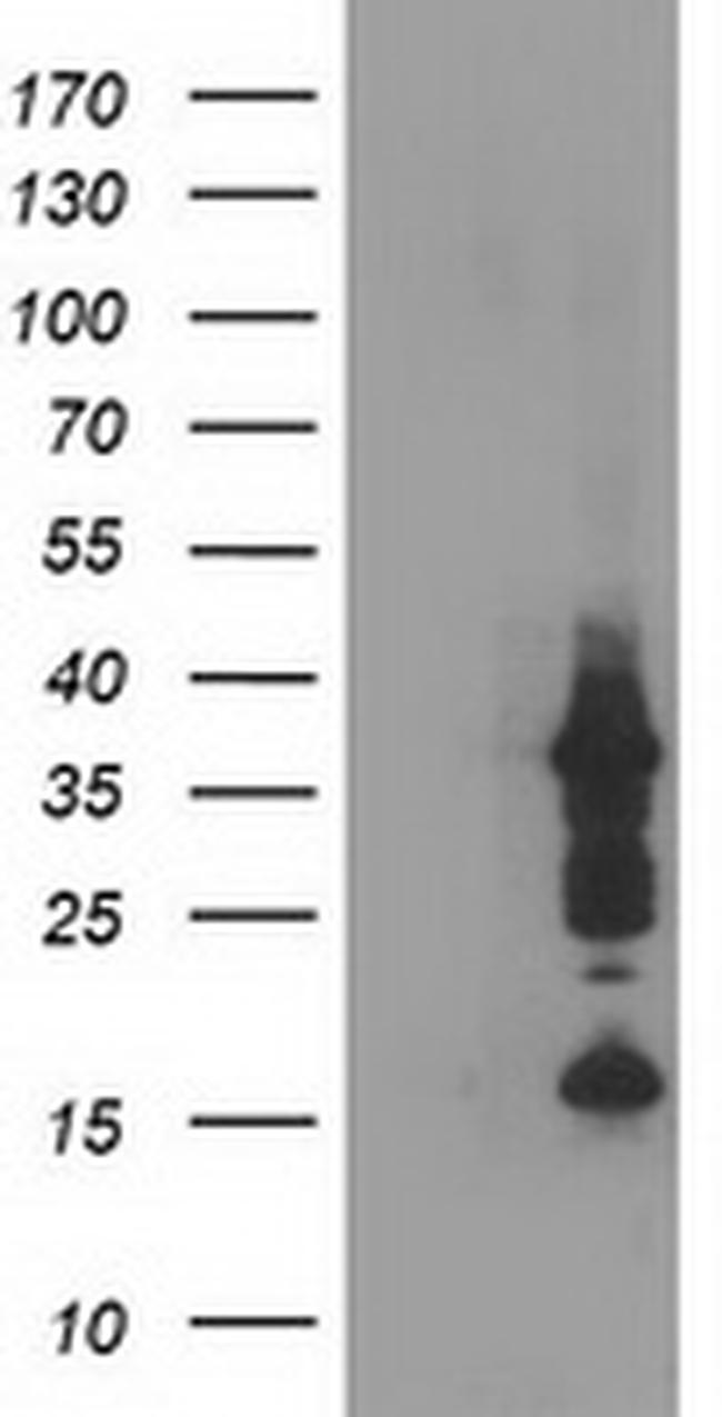 PDLIM2 Antibody in Western Blot (WB)