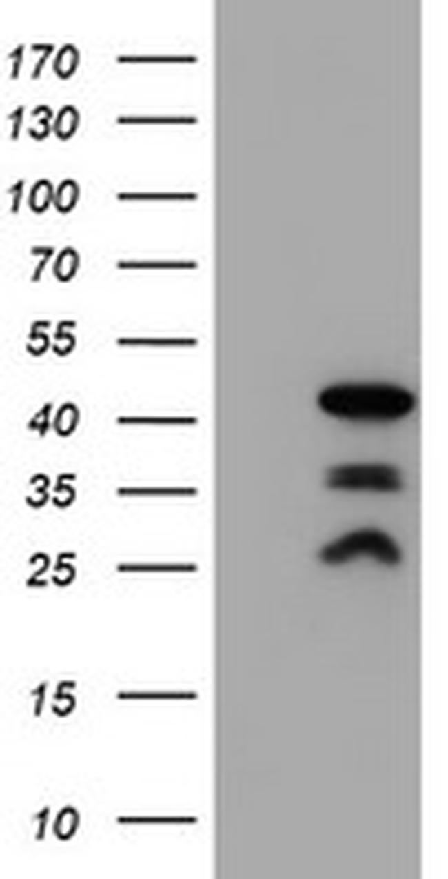 PDLIM2 Antibody in Western Blot (WB)