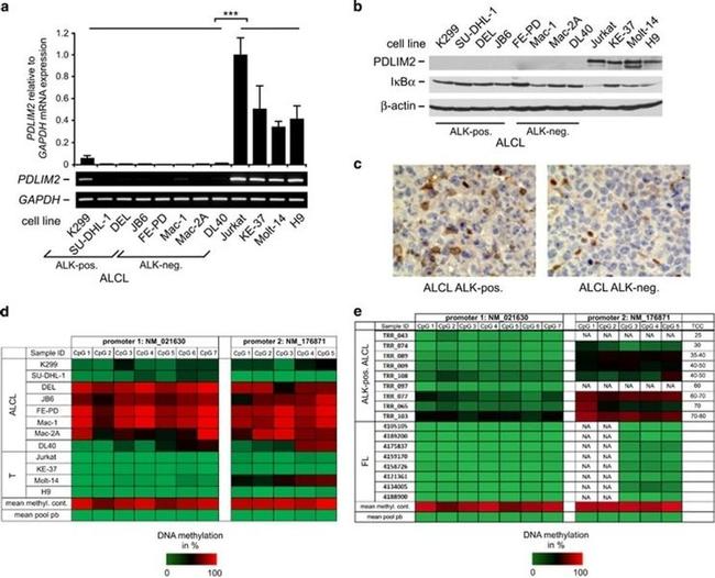 PDLIM2 Antibody in Immunohistochemistry (IHC)