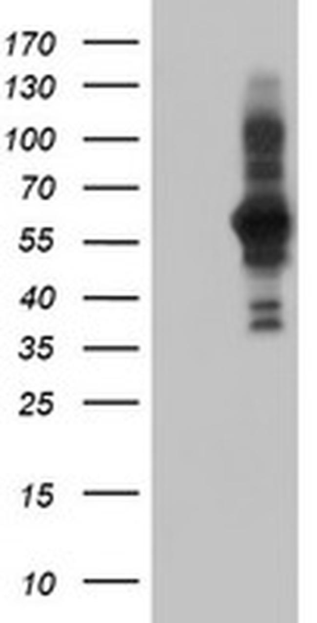 PDLIM5 Antibody in Western Blot (WB)