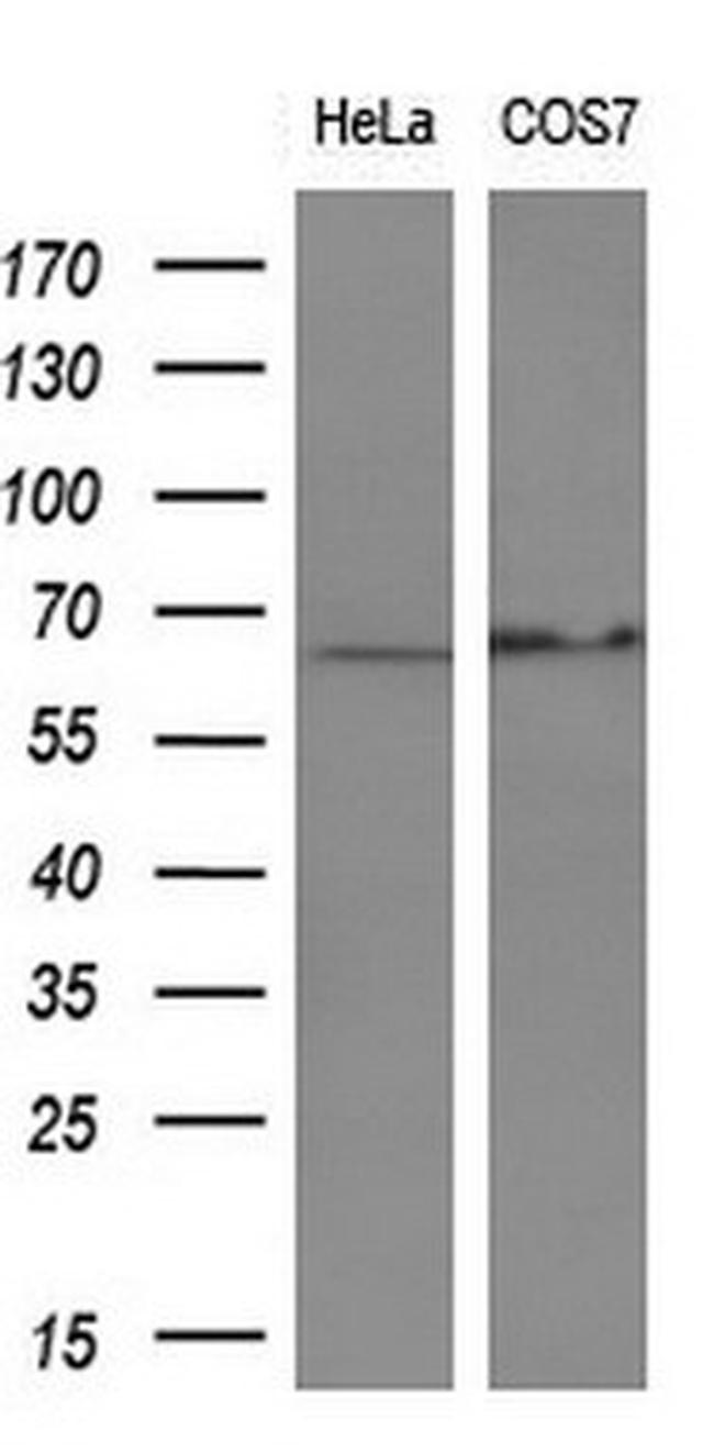 PDLIM5 Antibody in Western Blot (WB)