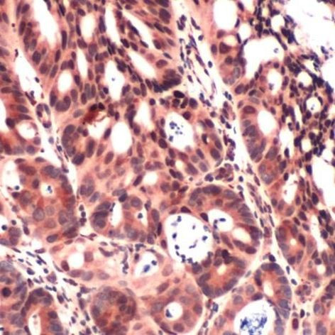 IGF2 Antibody in Immunohistochemistry (IHC)