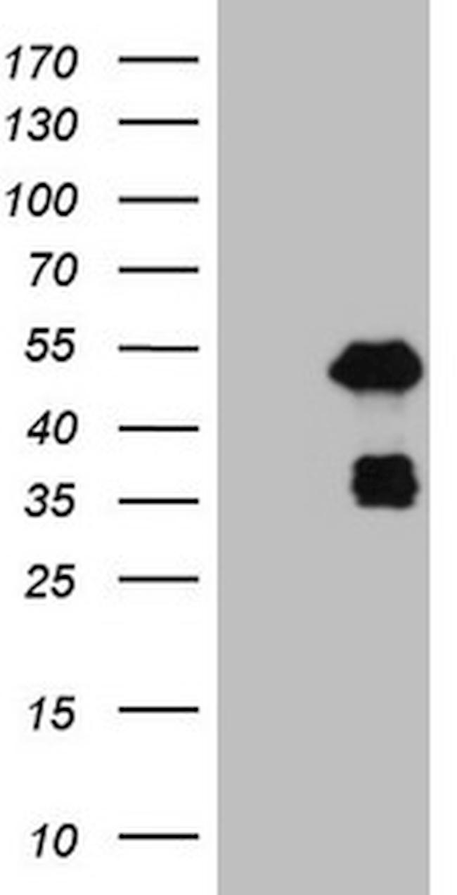 PDX1 Antibody in Western Blot (WB)