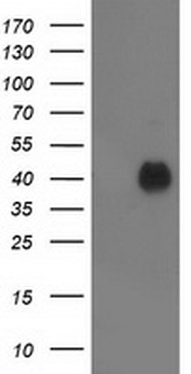 PDXK Antibody in Western Blot (WB)