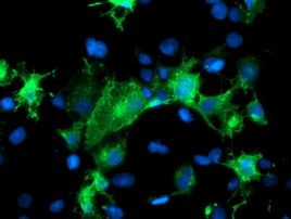 PECAM1 Antibody in Immunocytochemistry (ICC/IF)